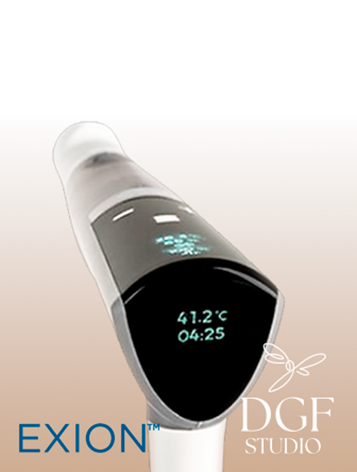 exion EMFEMME 360